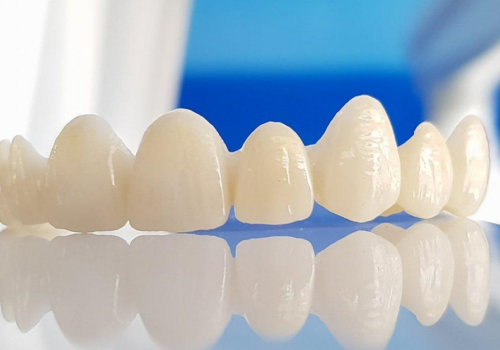 Zirconia Crown