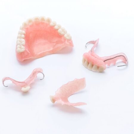 dental bridge