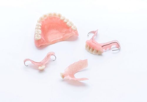 dental bridge