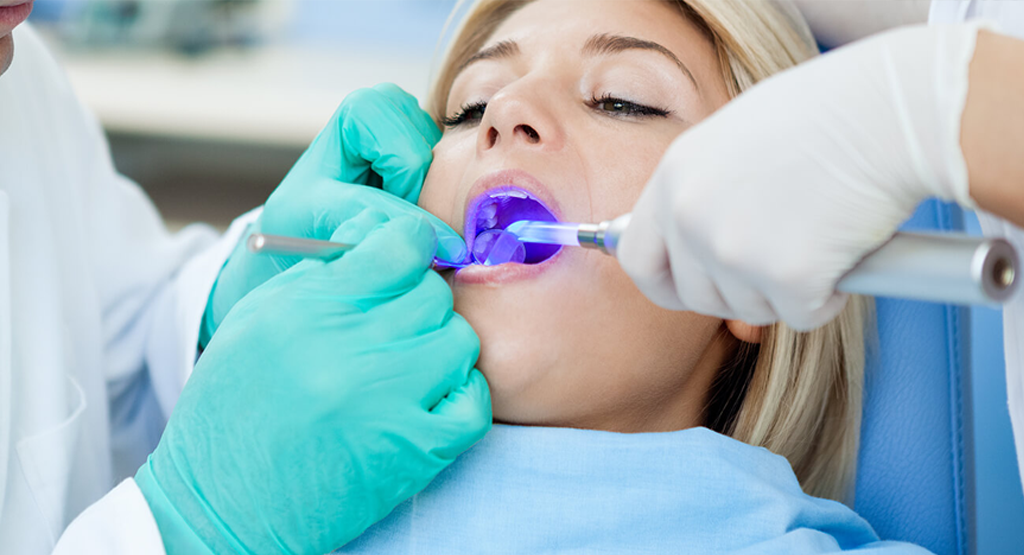What You Need to Know About Ozone Therapy for Teeth UDENZ