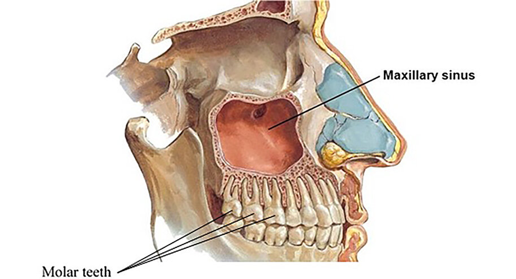 sinus-pressure-in-teeth-udenz-mena-dental-platform