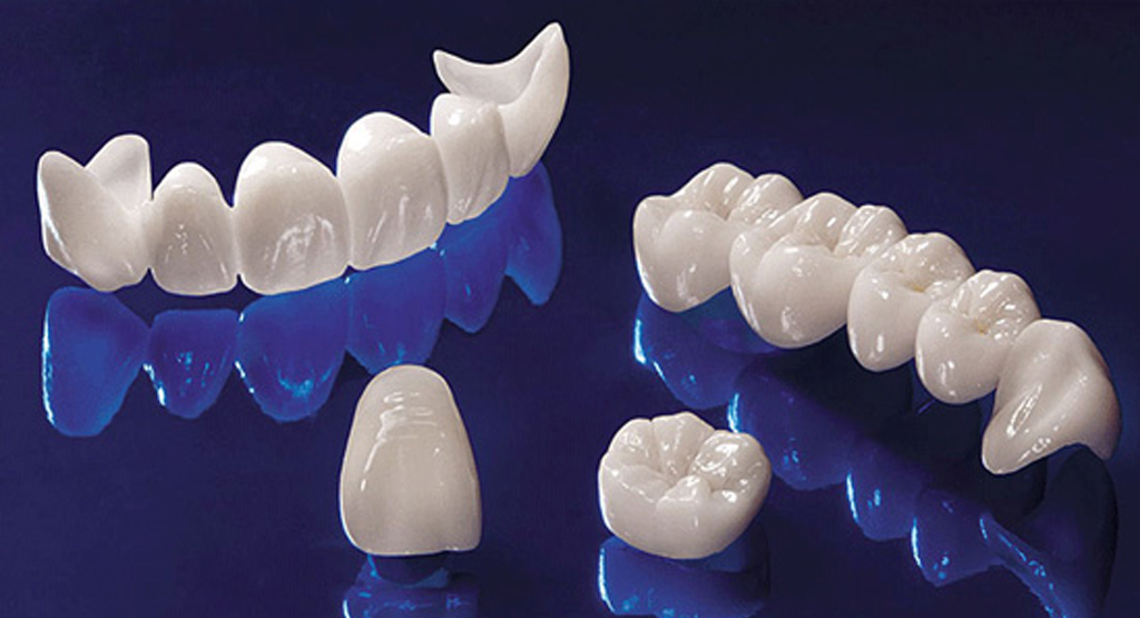 The Three Types of Zirconia Crowns UDENZ MENA DENTAL PLATFORM