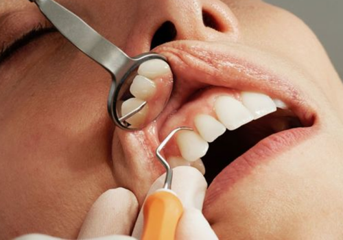 zirconia crowns making