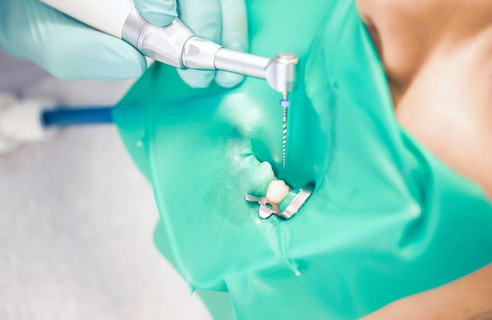 How Root Canal Treatment Can Treat an Infected Tooth?