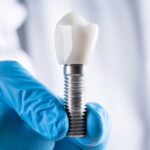 What is The Dental Implant?