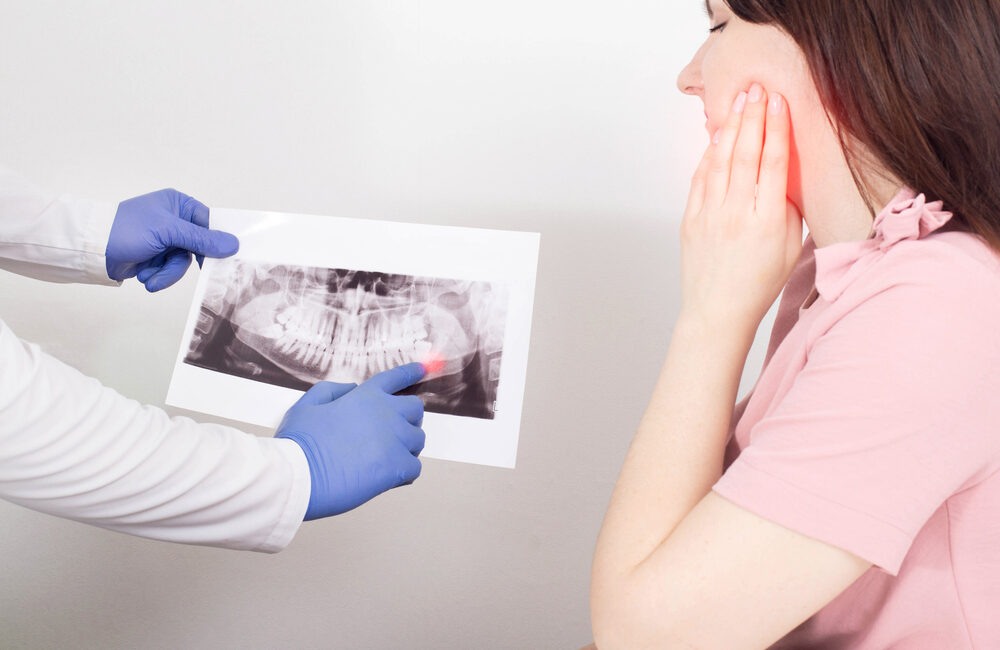 Wisdom Teeth Removal: When Do They Need To Be Extracted?