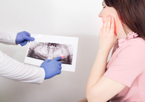 Wisdom Teeth Removal: When Do They Need To Be Extracted?
