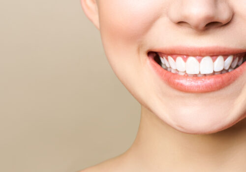 Dental Bonding vs. Porcelain Veneers