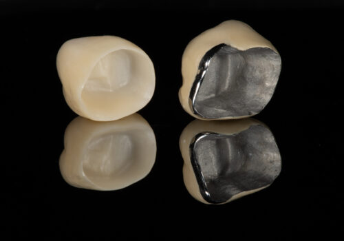 Dental Crowns: Purpose, Types, Procedure, Care, and Cost