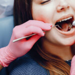 All You Need to Know About Tooth Contouring