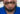 Causes of Tooth Discoloration and How to Prevent and Treat It?