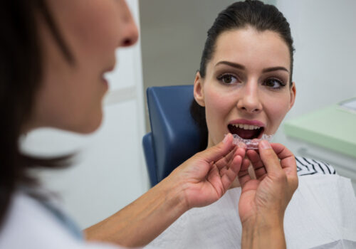 Benefits Of Invisalign