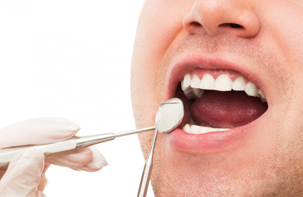 FAQs on Dental Bonding