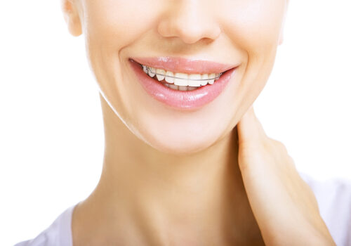 Frequently Asked Questions on Teeth Retainer