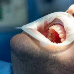Common Teeth Conditions
