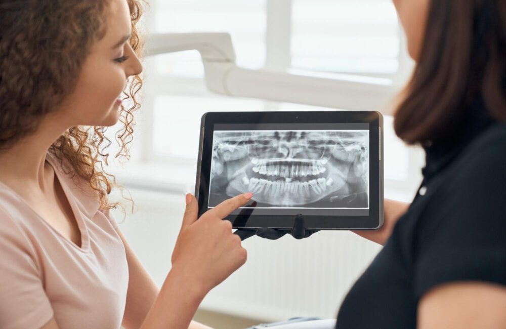 Dental X-Rays - Why They Are Important