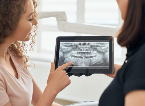 Dental X-Rays - Why They Are Important