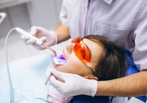 Professional Teeth Whitening