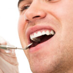 Signs & Symptoms of Gum Disease