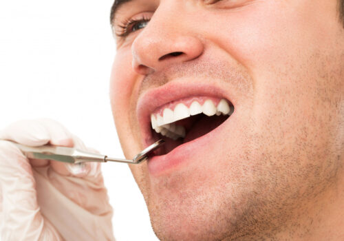 Signs & Symptoms of Gum Disease